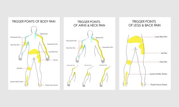 Lower Back Trigger Points - A Key To Lower Back Pain Relief